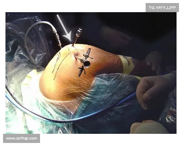 荷兰研究所发布蝶泳伤病报告 肩关节损伤率下降18%引关注